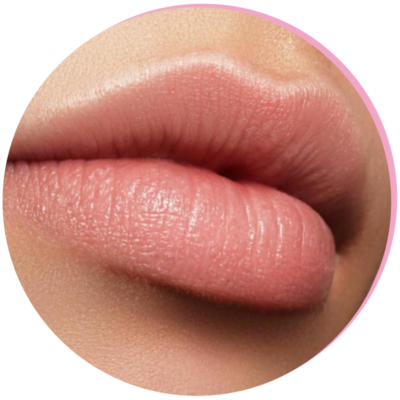 Surgical Lip Lift