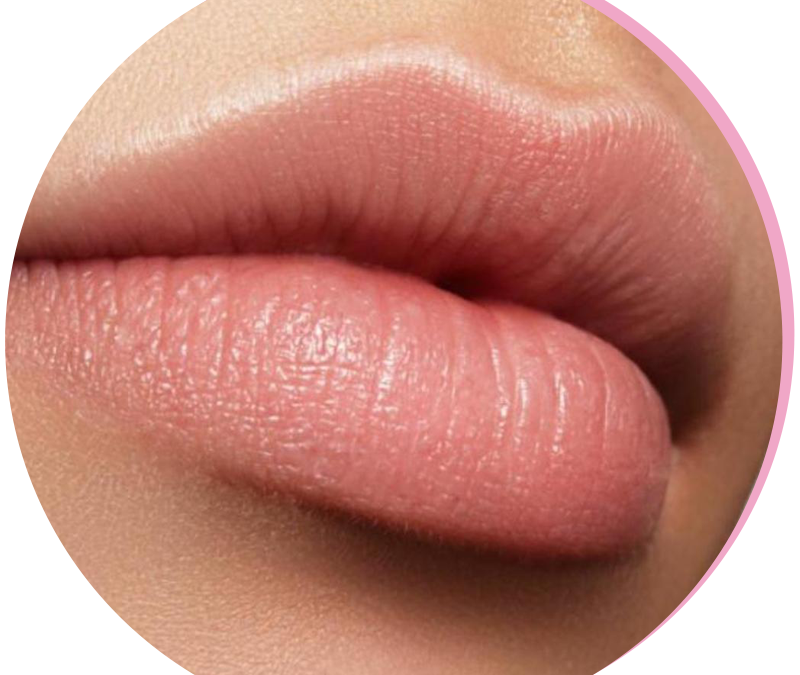 Surgical Lip Lift