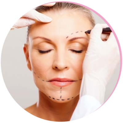 Surgical Face-lift