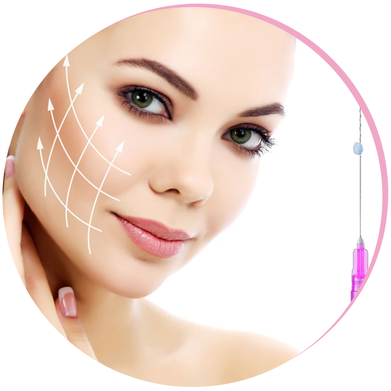 Bioszálas (Thread) lift