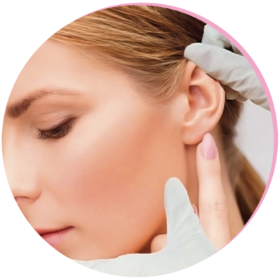 Otoplasty