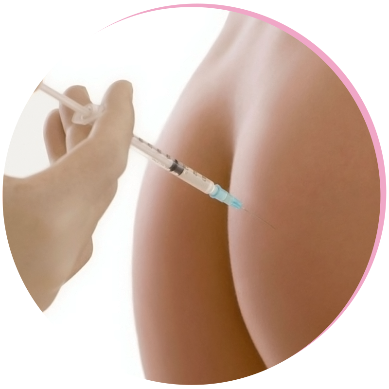 Sculptra fenékemelés és formálás